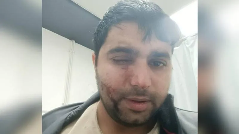 Kör bırakan saldırıya 2,5 ayda tahliye: Deliller dikkate alınmadı, adalet istiyorum