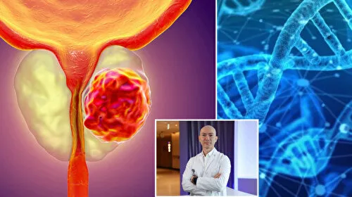 Prostat Kanseri Alarmı: Genetik Yatkınlık Riski Artırıyor!