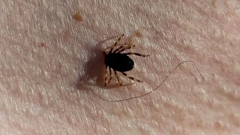 Sivas’ta KKKA Tanısı Konulan 6 Kişinin Tedavisi Devam Ediyor