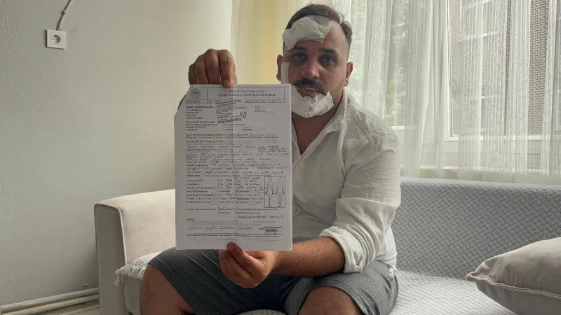 Taksici Eski Sözlüsü ve Polis Sevgilileri Tarafından Dövüldü İddiası!