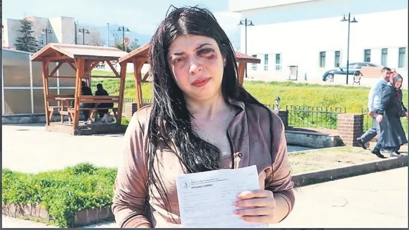 Yumruk gibi karar!